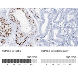 TSPYL6 Antibody, Novus Biologicals 0.1mL; Unlabeled:Antibodies, Polyclonal